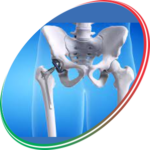 Total Hip Replacement